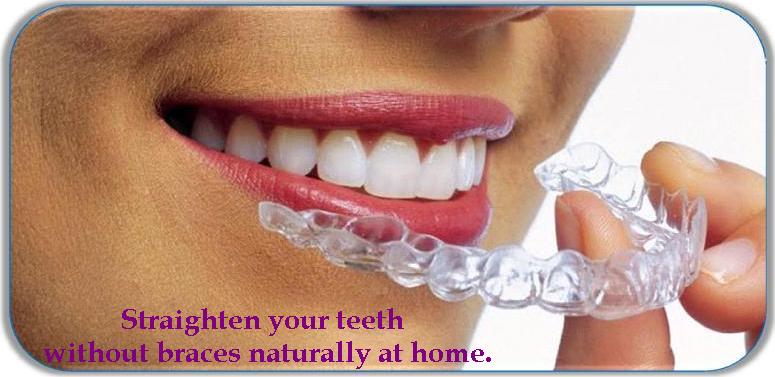 Dr Agravat Invisible Braces Offers Ahmedabad. India